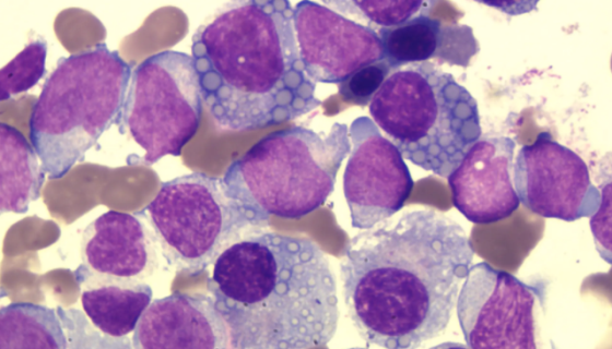 SKO-007人骨髓瘤细胞的培养操作规程！