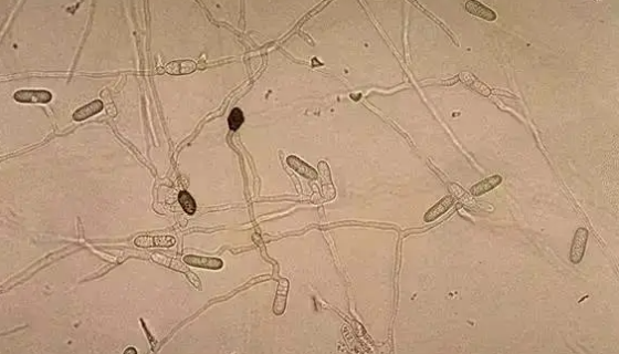 胶孢炭疽菌：用于该类群菌的系统学研究