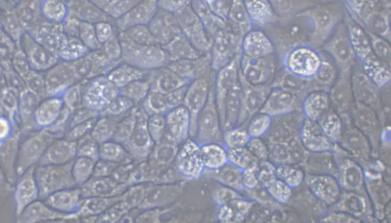 MOC2小鼠口腔鳞状细胞癌细胞的培养操作步骤！