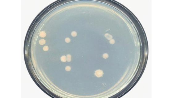 产氮假单胞菌的培养方法与实验内容及使用范围！