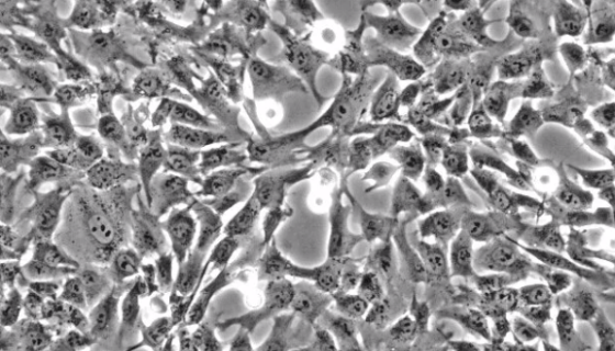 WISH（人羊膜细胞）的处理方法与培养步骤！