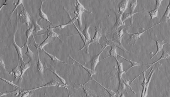 人雪旺细胞永生化的使用方法与培养操作步骤！