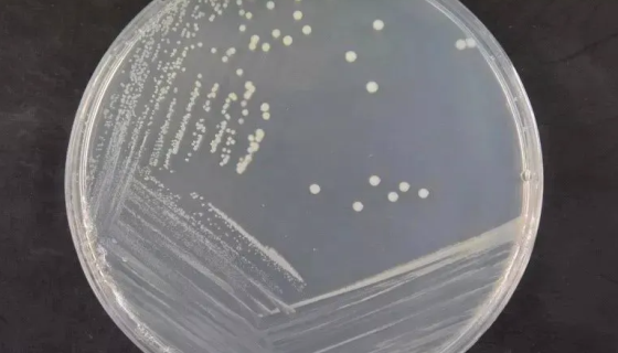 恶臭假单胞菌与产黄纤维假单胞菌联合使用：分解纤维素