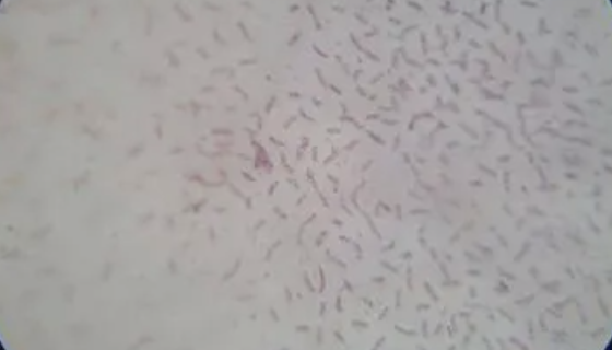 褐色高温单孢菌的性质与分类及培养方法！