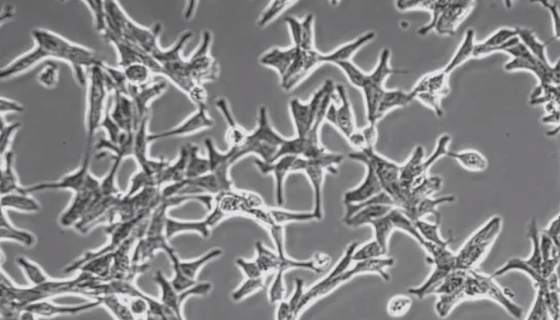 NCI-H660人神经内分泌前列腺癌细胞的培养步骤！