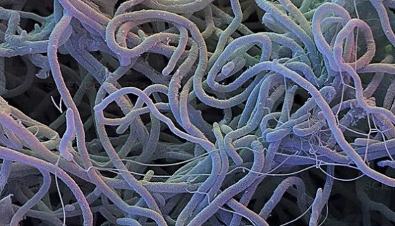 弯曲高温单孢菌的实验内容及培养与保藏方法！