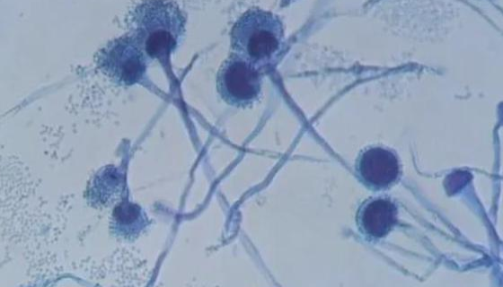 巴斯德毕赤酵母冻干管打管说明及注意事项！