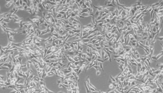 B16-F10+Luc小鼠黑色素瘤细胞荧光素酶标记