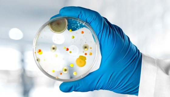 微生物限度检查中常见的问题分析及操作方法！