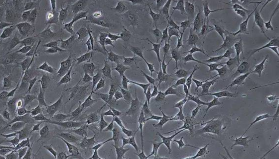 小鼠肺动脉平滑肌细胞的培养方法及操作步骤！