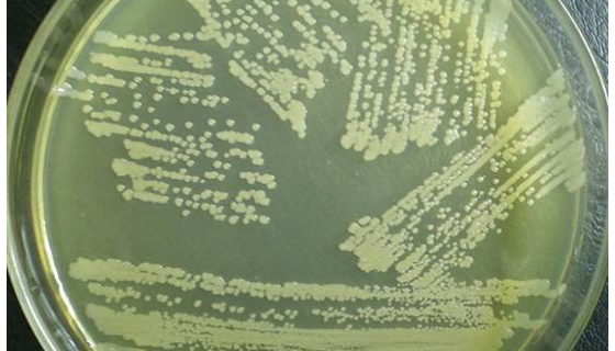 Saccharopolyspora Pogona的注意事项有哪些？