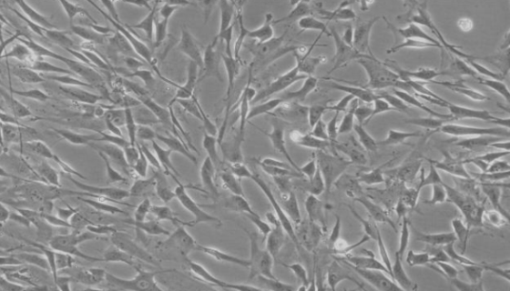 FLS人成纤维样滑膜细胞的处理方法与培养步骤！