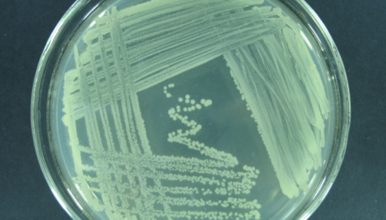 水雷夫松氏菌的培养方法与实验内容及使用范围！