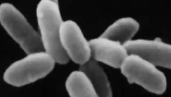 甲烷杆菌的发现过程与培养条件及主要应用！