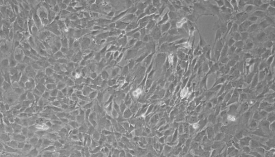 TRAMP-C2小鼠前列腺癌细胞的培养操作方法！