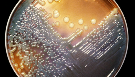 产气肠杆菌的性质、用途及生产工艺！