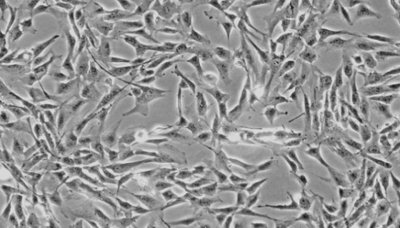 原代细胞人淋巴管内皮细胞的分离方法与质量检测！