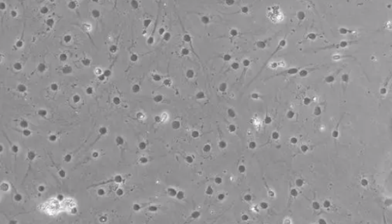 大鼠肝枯否细胞的质量检测与培养操作方法！