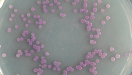 需钠弧菌的储存条件与培养条件及注意事项！