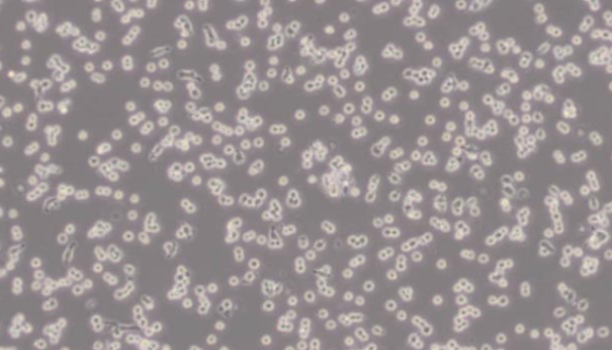 C1498小鼠白血病细胞的处理方法与培养步骤！