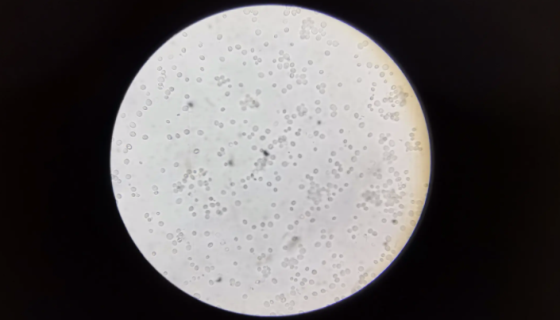 少孢酵母的培养方法及冻干管打管说明！