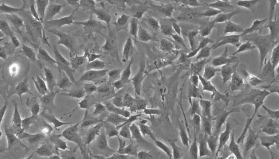 人脑血管平滑肌细胞的培养操作说明及注意事项！