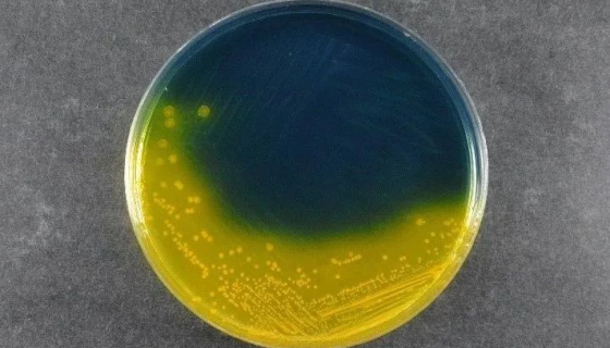 TCBS琼脂弧菌检测的方法和手段准确吗？