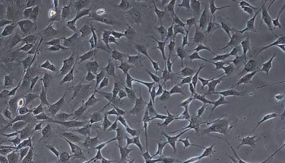 大鼠胰腺外分泌细胞的处理方法与培养步骤！