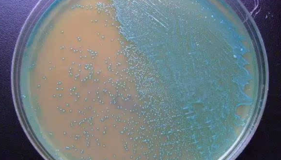 ATCC 27013 杀鲑气单胞菌日本鲑亚种