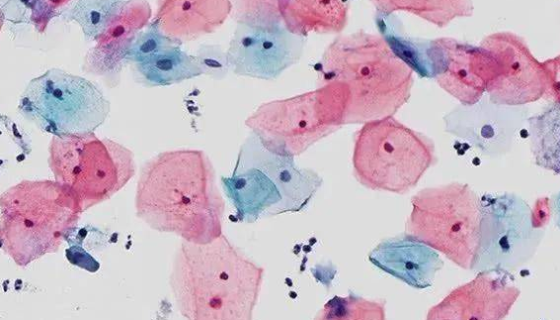 HUCEC人正常宫颈上皮细胞常规培养操作流程！