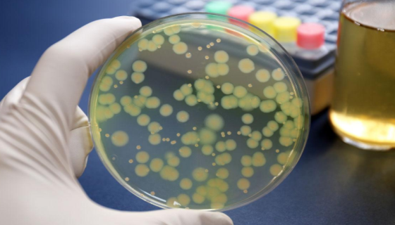 浅绿黄假单胞菌的形态特征及培养与保存方法！