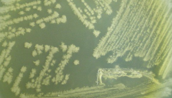 坚强芽孢杆菌的应用发明及学术与文献研究！