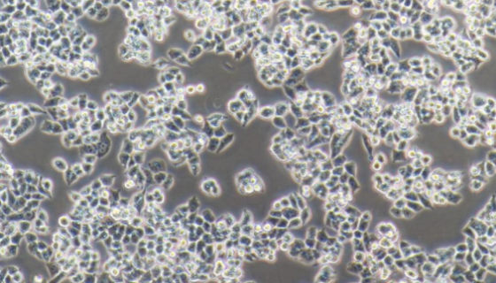 CP70人卵巢癌细胞的培养操作步骤及注意事项！