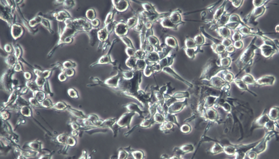 MDCK犬肾细胞的培养操作步骤及应用！