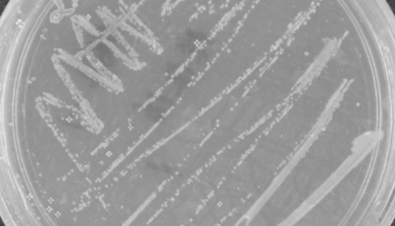 叶片微杆菌的培养方法与实验内容及使用范围！