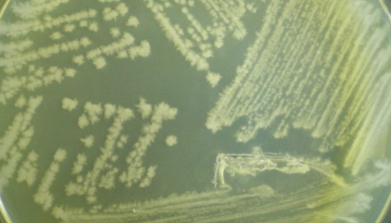 耐盐芽孢杆菌——产β-半乳糖苷酶和木聚糖酶