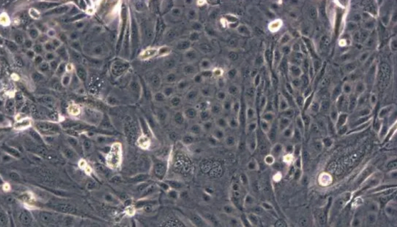 小鼠膀胱癌细胞接收后的操作流程与培养步骤！