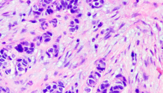 人髓母细胞瘤组织源细胞的分离方法与质量检测！