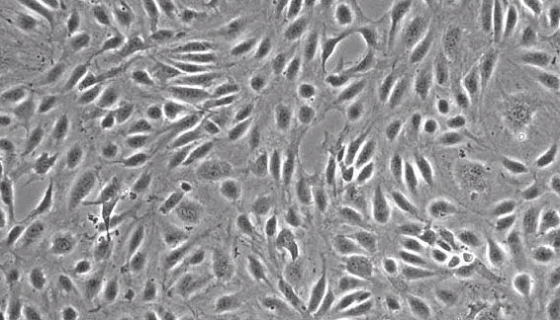HBMEC人脑微血管内皮细胞的传代培养及应用！