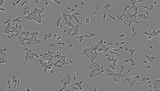 大鼠胰岛素瘤细胞的复苏操作要点及应用！