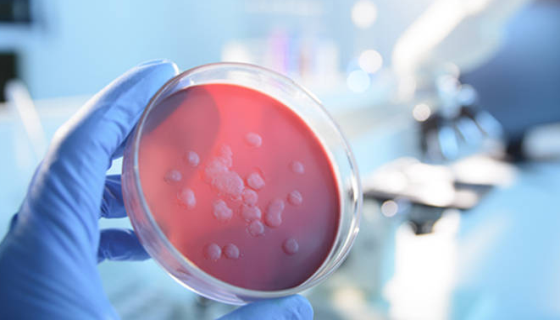 微生物检测过程中的常见问题及解答！