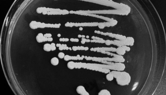 异常威克汉姆酵母的培养方法与使用范围！