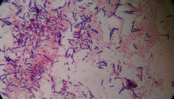 ATCC 27606 诺维氏梭菌微生物培养方法！