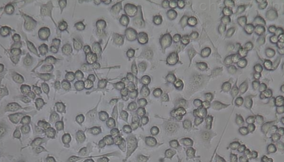 小鼠颗粒细胞系的复苏与传代及冻存操作说明！