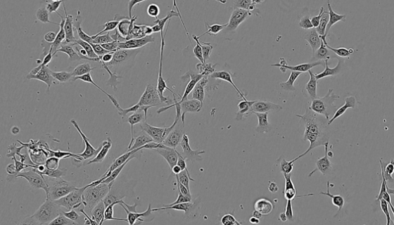 人脐静脉内皮细胞永生化接收后的处理方法与培养步骤！