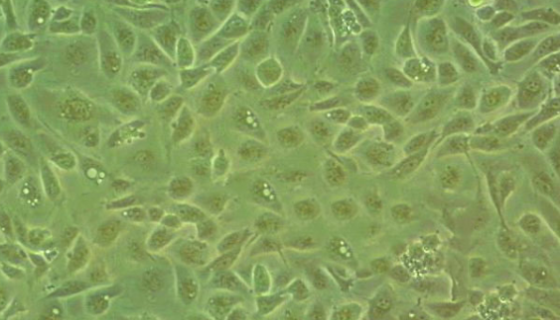 人正常结肠上皮细胞的培养操作规程及步骤！