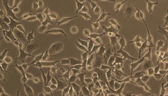 大鼠Ⅱ型肺泡上皮细胞的背景与应用！