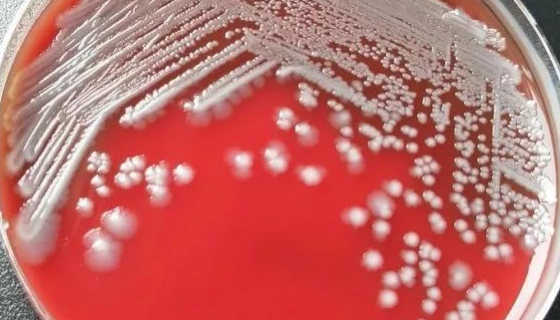 动物源性食品中细菌的检测——志贺氏菌