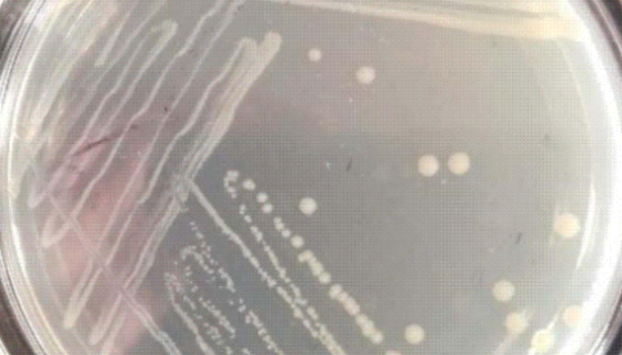 ATCC 11996 睾丸酮丛毛单胞菌 百欧博伟生物