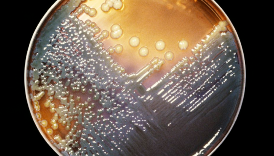 产气肠杆菌——用于教学与研究及异淀粉酶